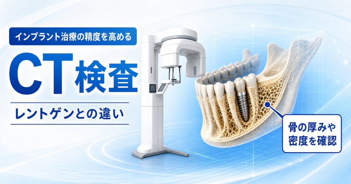 インプラント治療の検査でCTはなぜ必要？　レントゲンとの違いと重要性
