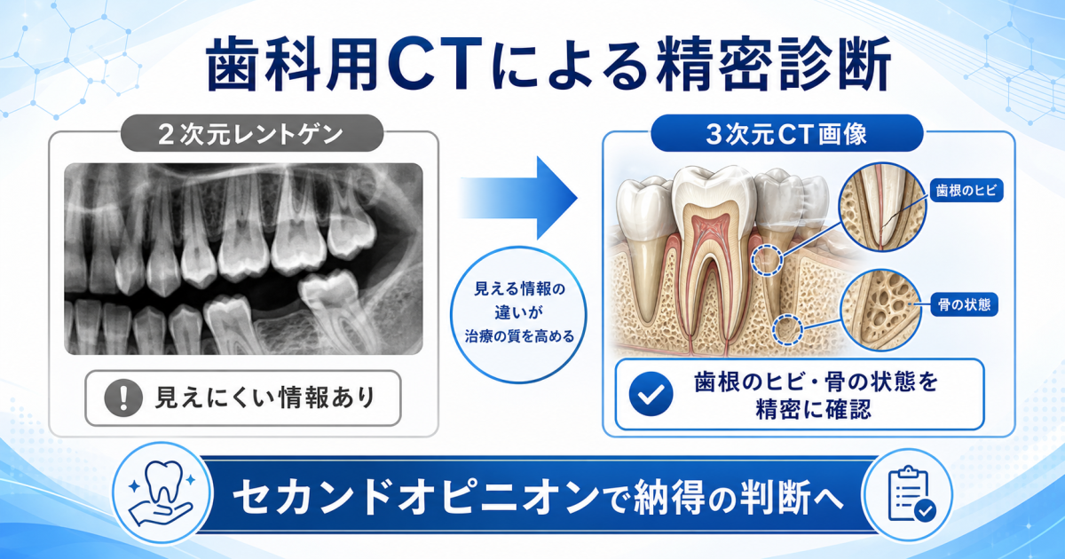 「もしかして抜歯?」自分自身で気づくための歯の限界サイン