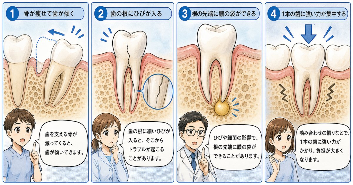 歯がグラグラして噛むと痛いときに考えられる4つの原因