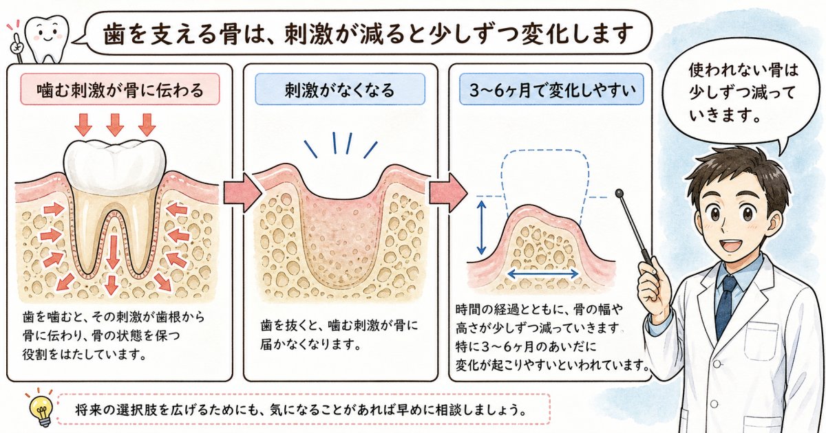 抜歯後にあごの骨が溶ける（骨吸収）仕組みと進行スピード
