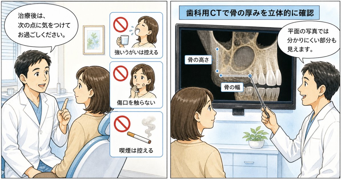 骨吸収を抑えるための対策と歯科用CTを活用した確認方法
